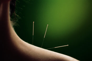 Port Moody Acupuncture